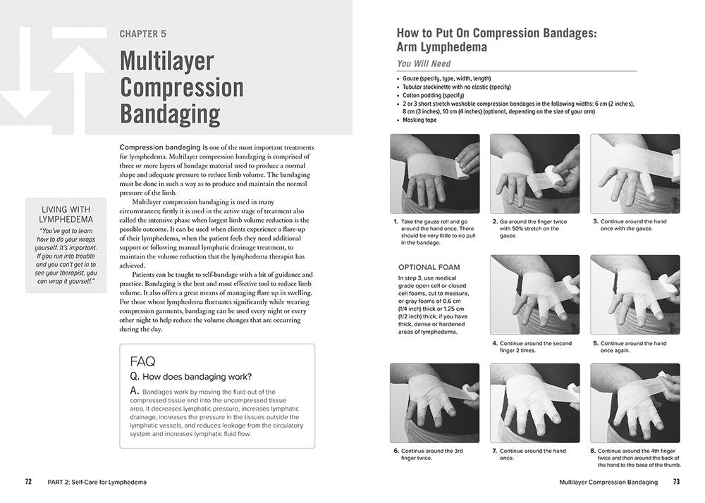 The Complete Lymphedema Management and Nutrition Guide